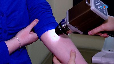 В каком случае нужно проверить родинку