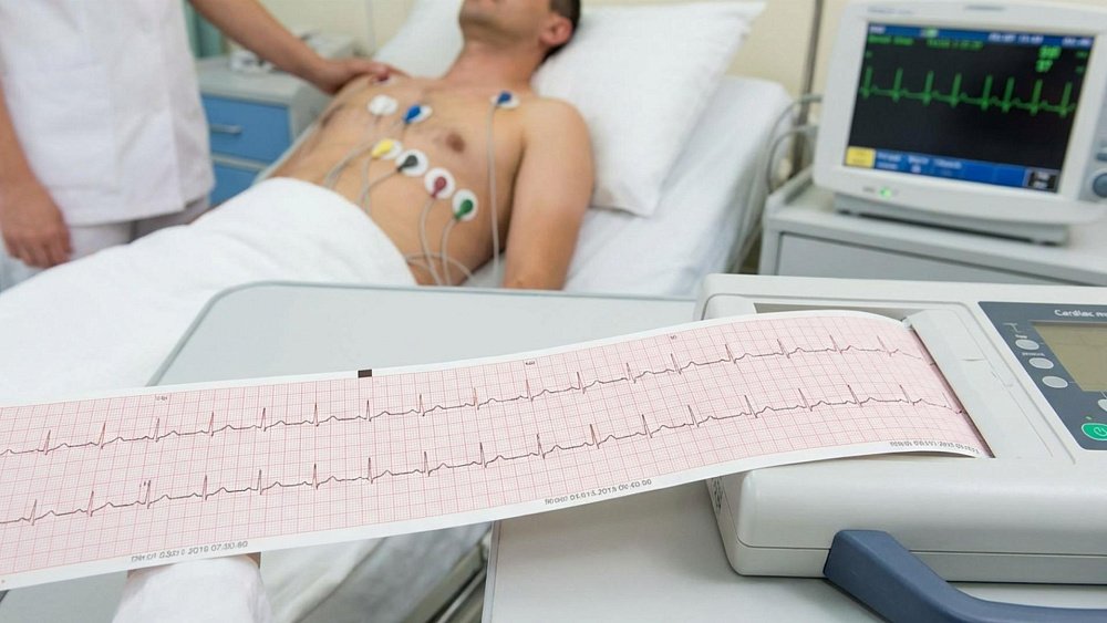 Эти симптомы говорят о сбоях в сердце