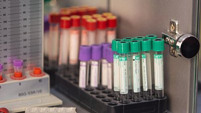 «Школа здоровья»: важные советы врачей для сильного пола