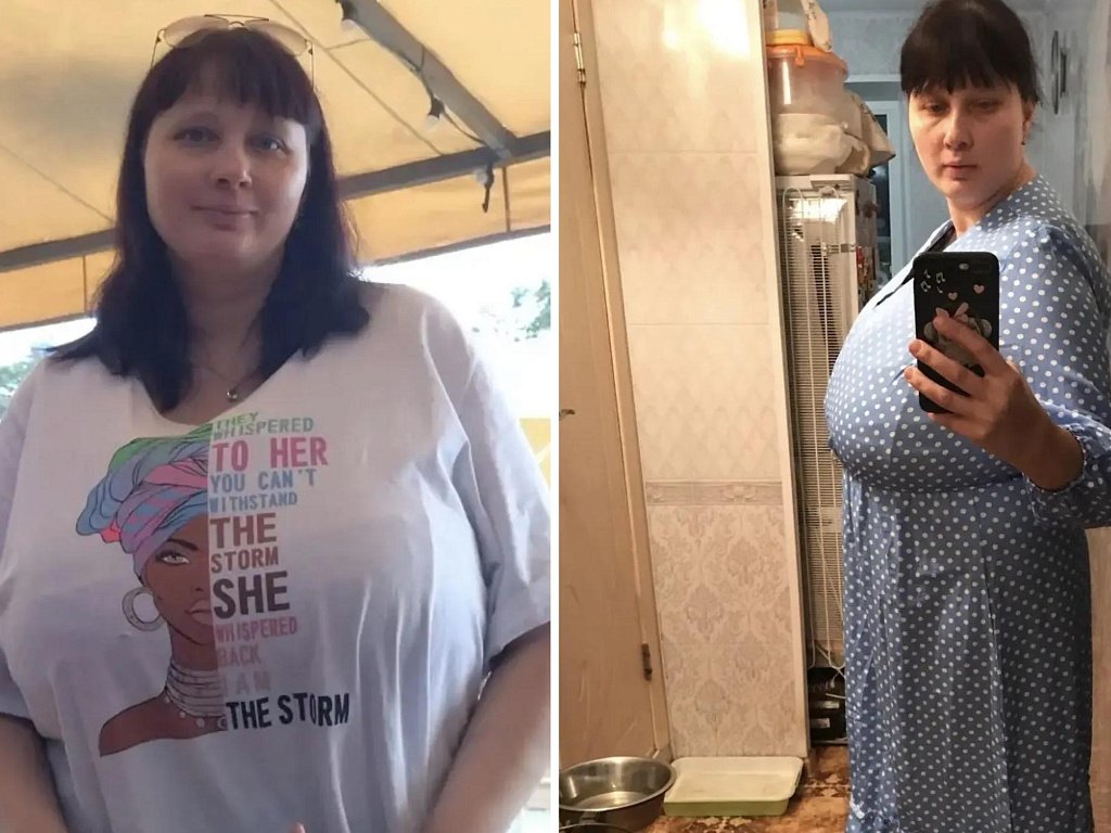 После измены мужа у челябинки выросла гигантская грудь