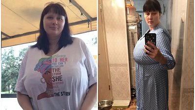 После измены мужа у челябинки выросла гигантская грудь