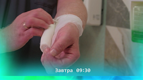 Как оказать первую помощь при ожоге?