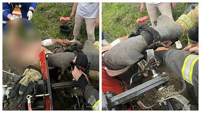 Житель Верхнего Уфалея получил перелом ноги во время работ на огороде