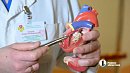 Ученые из Челябинска и Китая описали механизм гибели клеток сердца после инфаркта