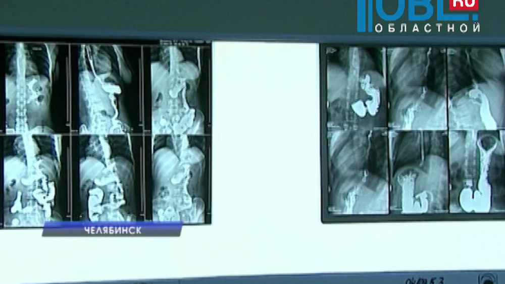 Хирург областной больницы спас женщину на борту самолета