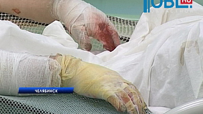 Трое рабочих ЧМЗ получили глубокие ожоги 