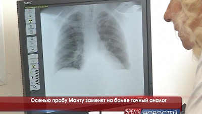 Осенью пробу Манту заменят на более точный аналог