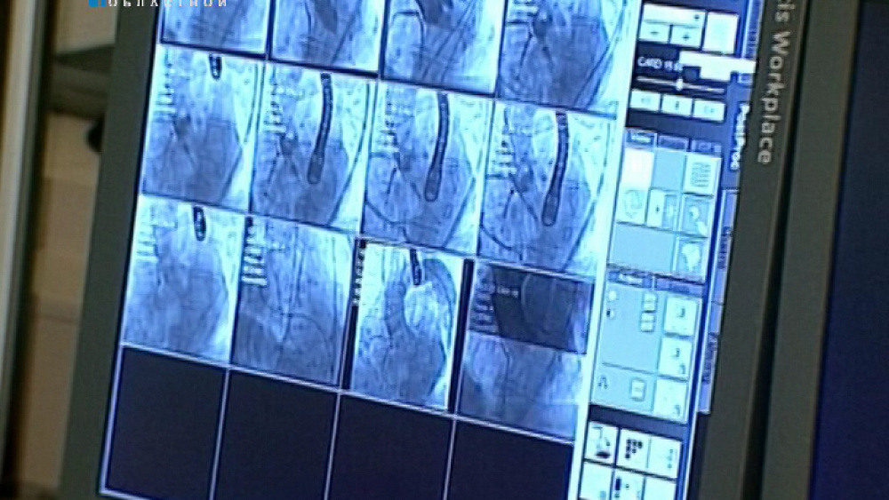 Хирурги кардиоцентра делают операции на сердце без открытых разрезов