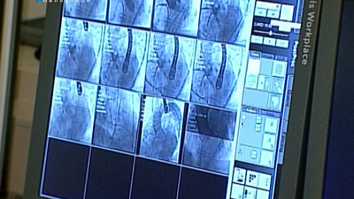 Хирурги кардиоцентра делают операции на сердце без открытых разрезов