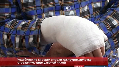 Челябинские хирурги спасли южноуральцу руку, отрезанную циркулярной пилой