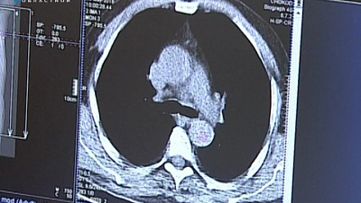 Препарат для диагностики онкозаболеваний теперь синтезируют на отечественном аппарате