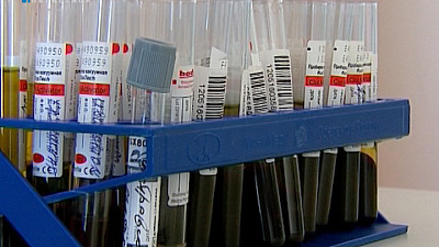 Женщина с диагнозом "системная красная волчанка" родила здорового ребенка