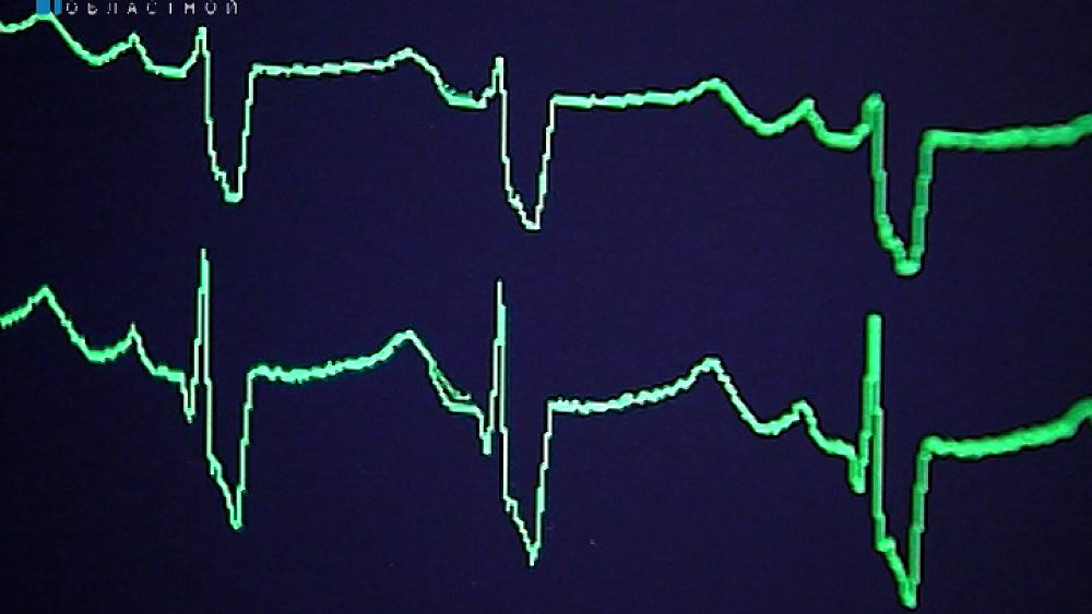 Кардиохирурги из Америки поделятся опытом с южноуральскими специалистами