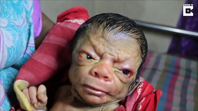 Ребёнок с лицом 90-летнего малыша