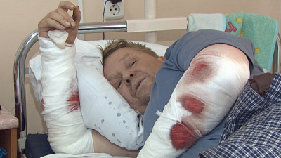 Ротвейлеры растерзали прохожих