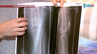 Жительница Залесья требует от коммунальщиков компенсацию за перелом колена