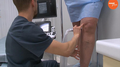 Что такое ультразвуковое исследование вен?  