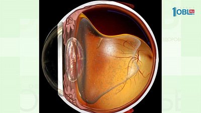 Жизнь с диабетом. Как избежать осложнений?