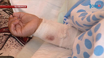 В горбольнице № 6 Челябинска открыли обновленное ожоговое отделение