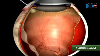О здоровье 18.03.2017