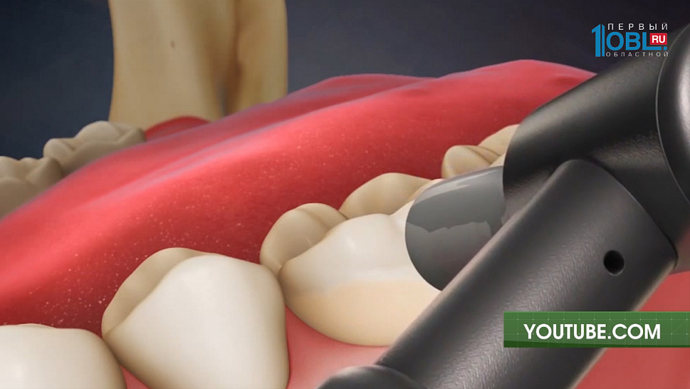 Гигиена полости рта