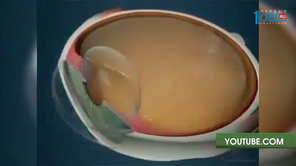 Лечение онкологии глаз