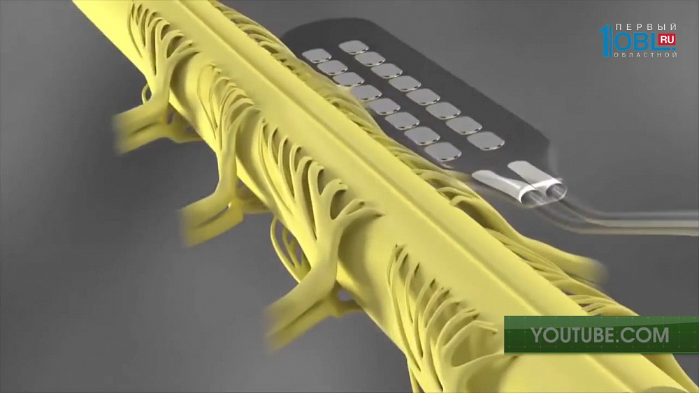 Электронное обезболивающее