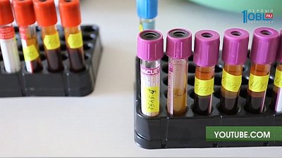 Чем опасен дефицит железа