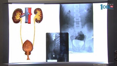 О здоровье 15.07.2017