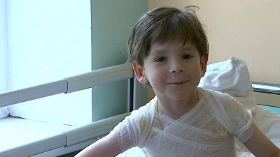 Обожжённый супом детсадовец и его мама рассказали об инциденте