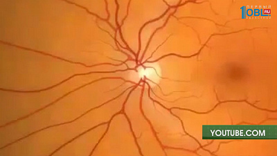 Лечение онкологии глаз