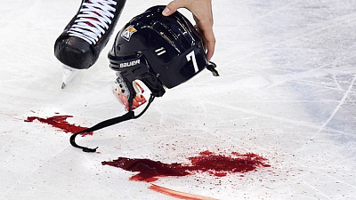 Кровавый момент матча «Металлург» vs «Ак Барс» 