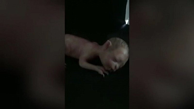 Ребенок с туловищем котенка поверг в шок интернет-пользователей 