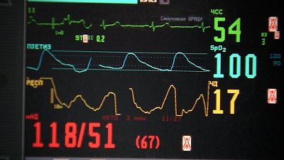 В челябинской больнице впервые сделали пересадку сердца