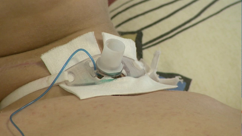 Для реабилитации Вани Шемшуры нужно 100 тысяч рублей