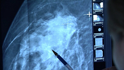 О здоровье 09.11.2017