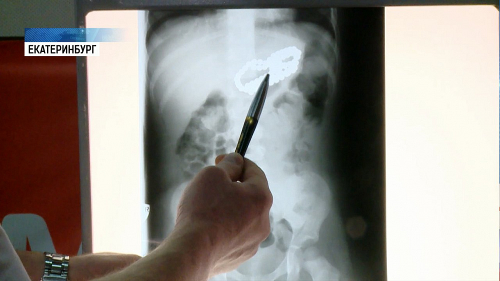 Дети стали чаще проглатывать детали игрушек