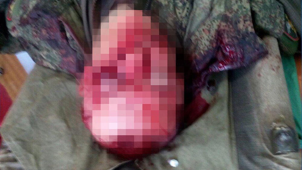 Южноуральского срочника нашли с огнестрельными ранениями