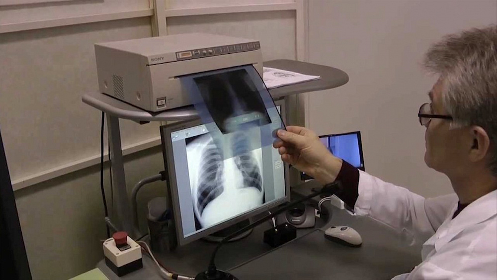 О здоровье 31.03.2018