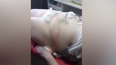 В сеть попало жуткое видео подпольной липосакции в Магнитогорске. 18+