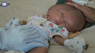 Ребенок с двумя лицами шокировал пользователей интернета 