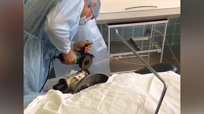 Промышленная мясорубка «зажевала» руку повара 