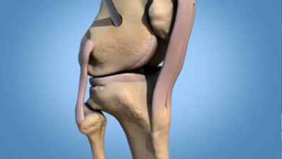 Челябинские хирурги освоили новый метод