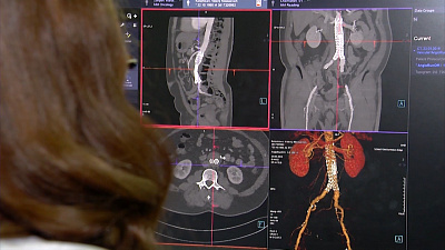 О здоровье 29.09.2018