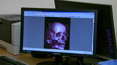 Молодая девушка, пострадавшая в страшном ДТП, смогла вернуться к прежней жизни