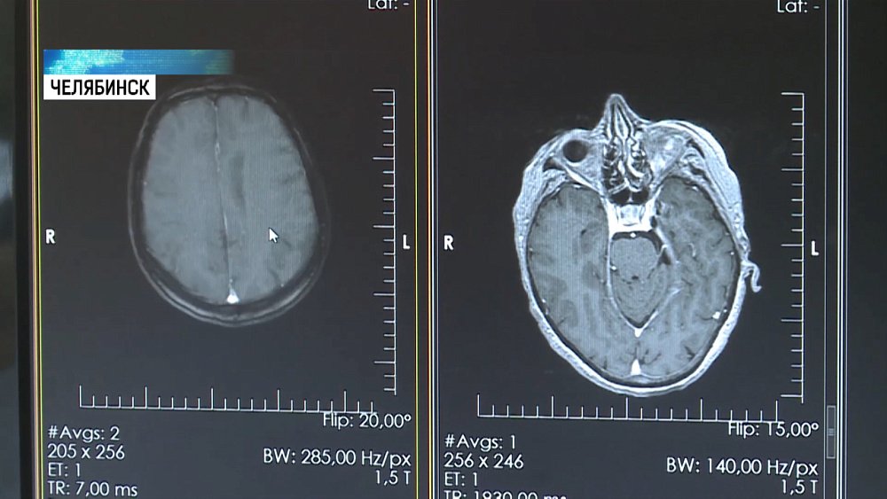 Вылечить невралгию тройничного нерва можно в Челябинске