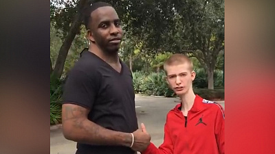 Преврати комплексы в мемы: американец с длинной шеей нашел друга с широкой шеей