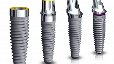 В Челябинске будут выпускать комплектующие для дентальных имплантов