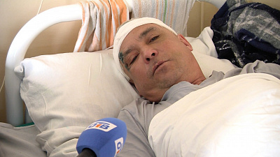 Вместо сервиса «сломали лицо». Пострадавший от ЧОПовцев описал детали конфликта