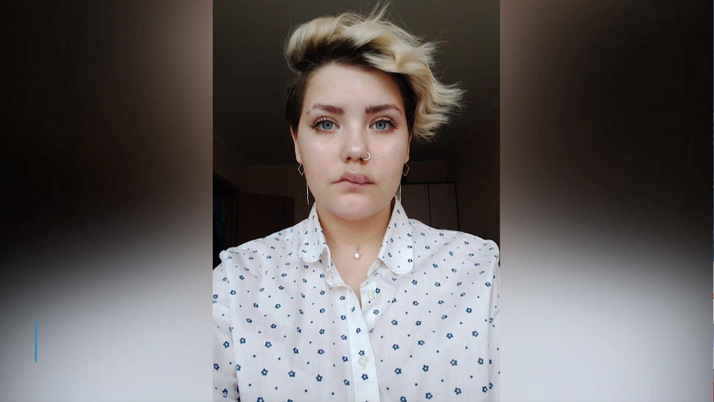 Компания отказала девушке из-за «дефекта внешности»